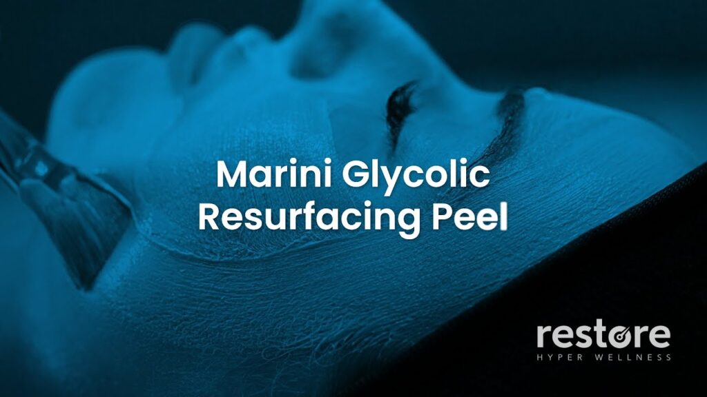 Can a Facial Peel River Oaks, TX, Boost Your Skin Health? 1 facial peel River Oaks, TX